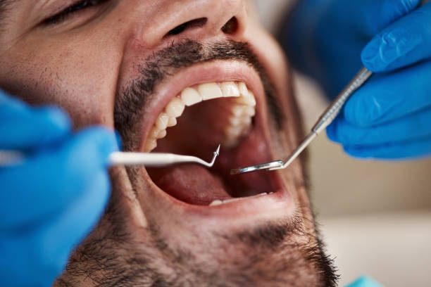 Best Emergency Dental Care for Sports Injuries in Fruitland, MD