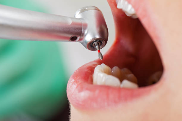 Best Emergency Dental Care for Sports Injuries in Fruitland, MD